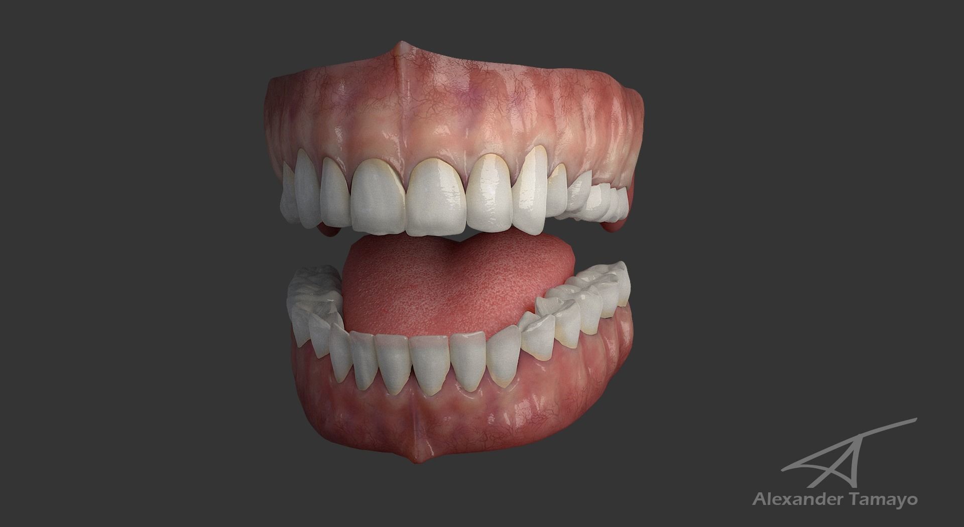 Teeth Example.jpg